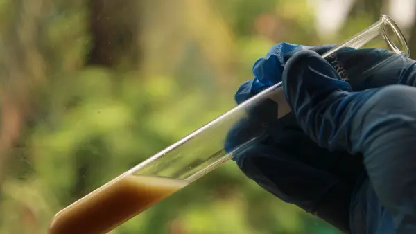 Pengiriman sampel ke laboratorium